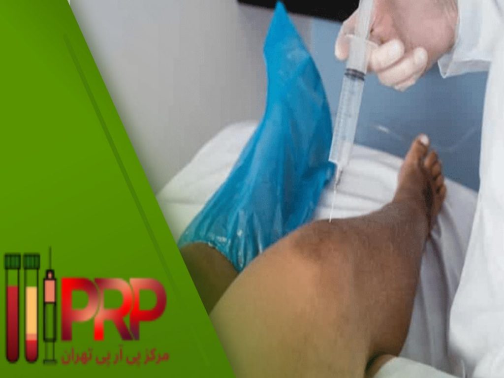 قبل و بعد از PRP پی ار پی زانو با بیمه
