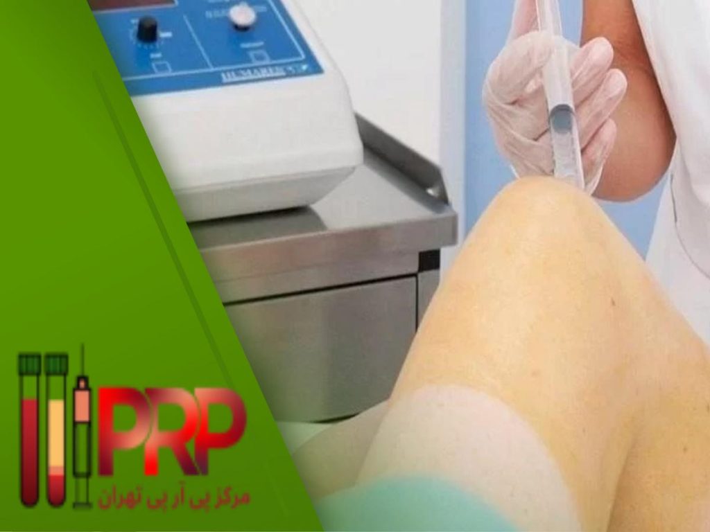 پی ار پی روش نوین پی ار پی زانو با بیمه