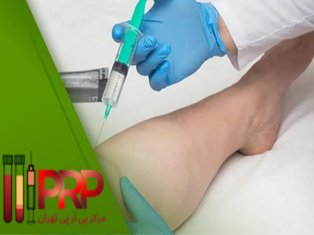 فیزیوتراپیست آیا پی آر پی زانو تحت پوشش بیمه است