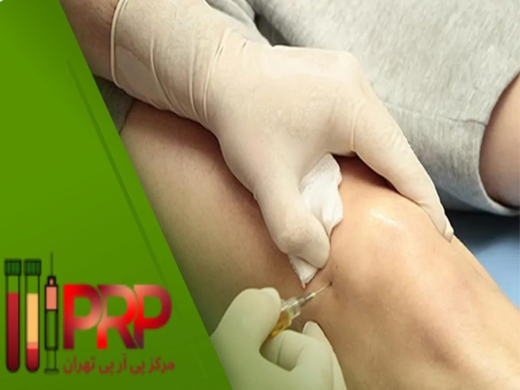 بیمه تأمین اجتماعی پی ار پی زانو بیمه تامین اجتماعی
