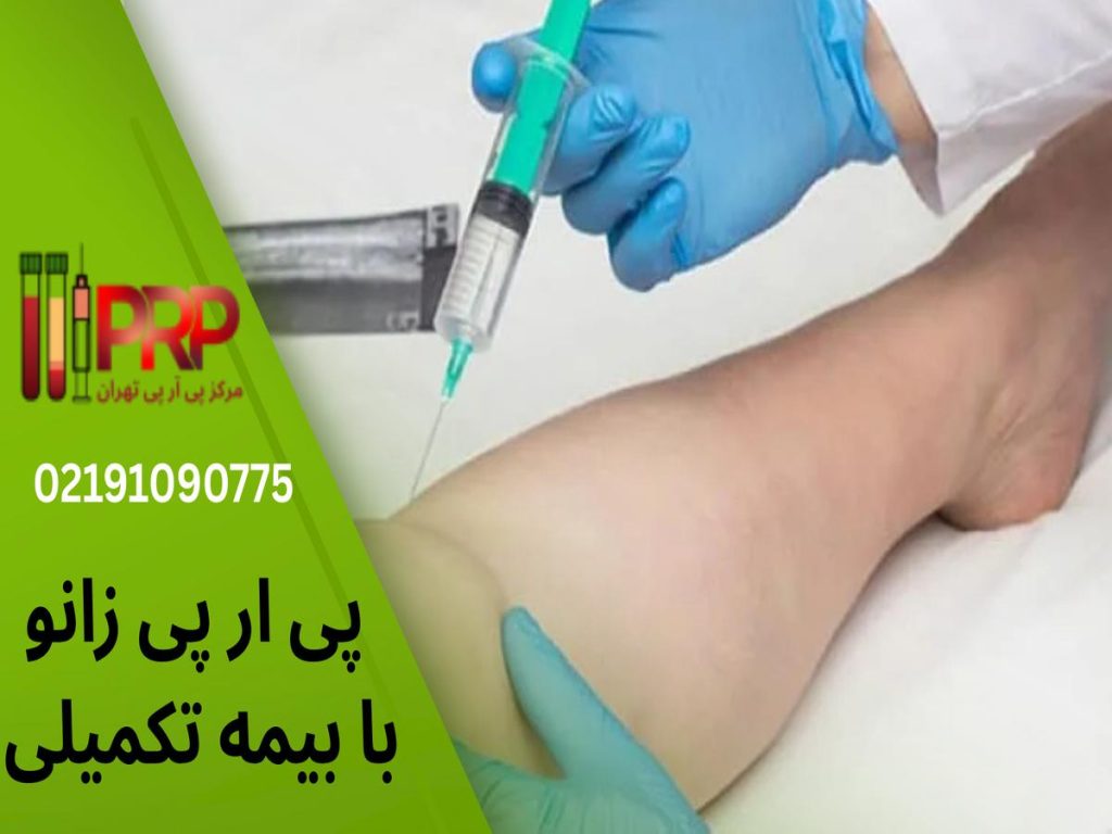 پی ار پی زانو با بیمه تکمیلی