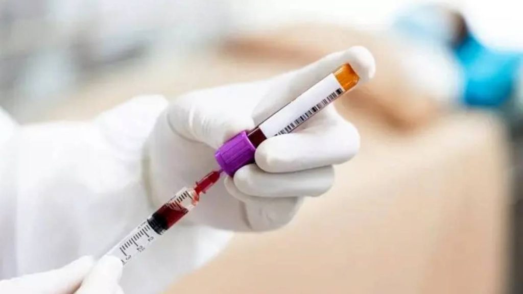 prp تخمدان كيا از پي ار پي تخمدان جواب گرفتن