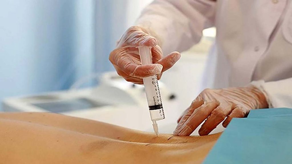 اوزون تراپی دیسک کمر هزینه اوزون تراپی دیسک کمر