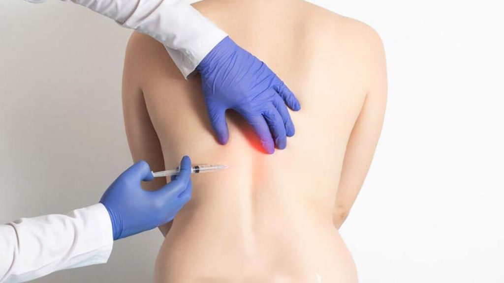 تزریق گاز اوزون به کمر هزینه اوزون تراپی کمر