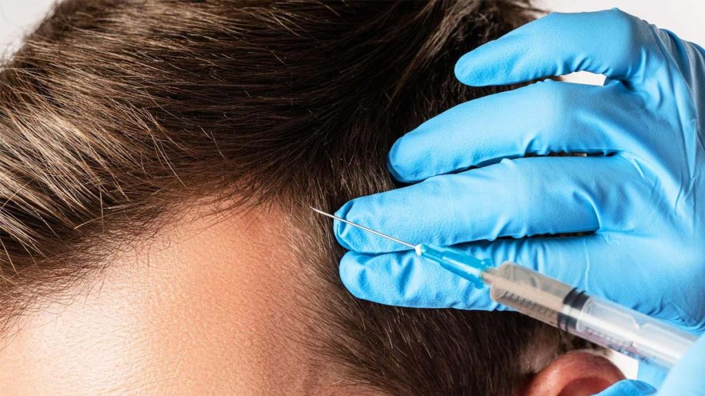 قیمت هر جلسه مزوتراپی