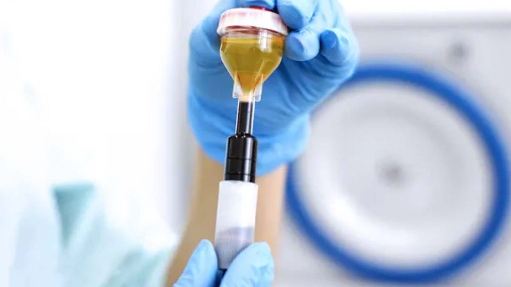 مراکز Prp بیمه دانا