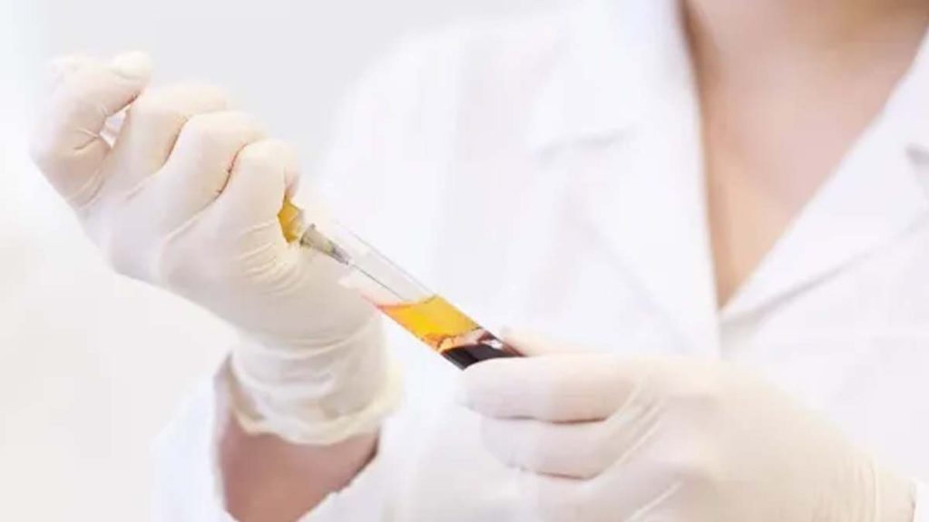 کلینیکهای پی ار پی با پوشش بیمه دانا مراکز Prp بیمه دانا در شمال تهران