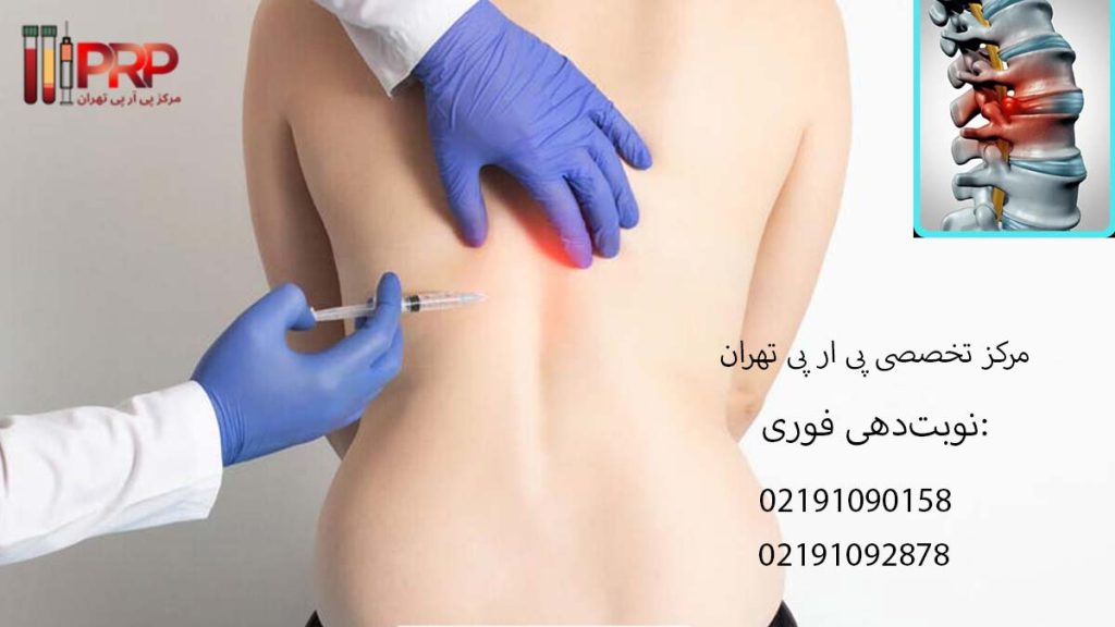 عوارض اوزون تراپی دیسک کمر