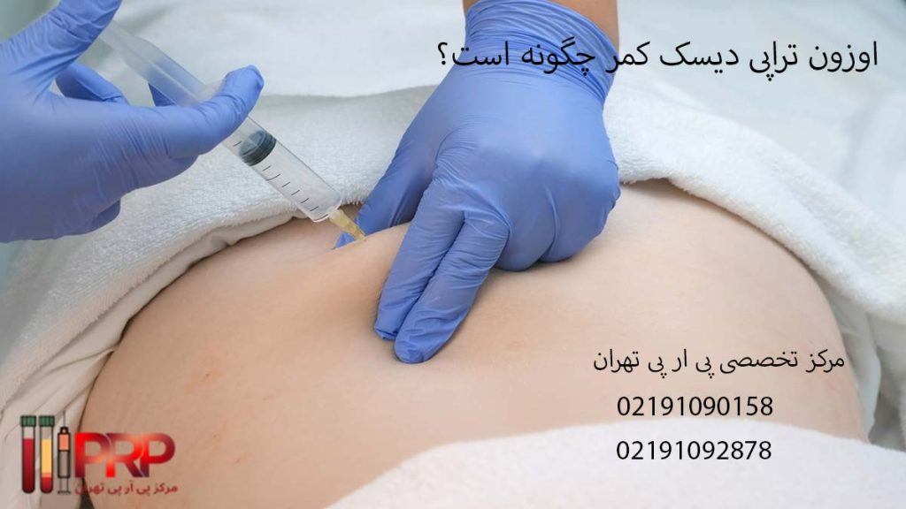 اوزون تراپی دیسک کمر چگونه است
