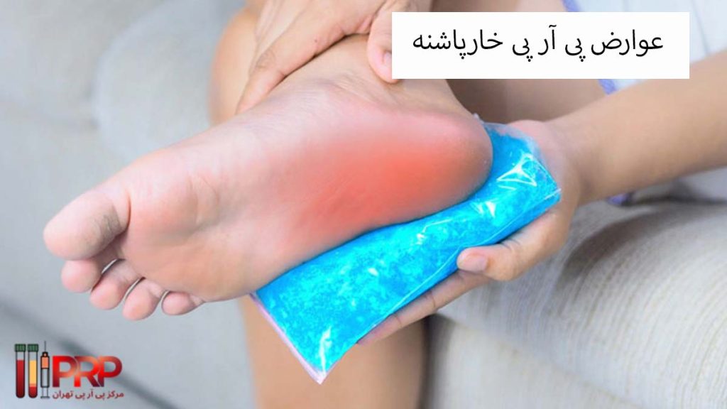 عوارض پی آر پی خارپاشنه