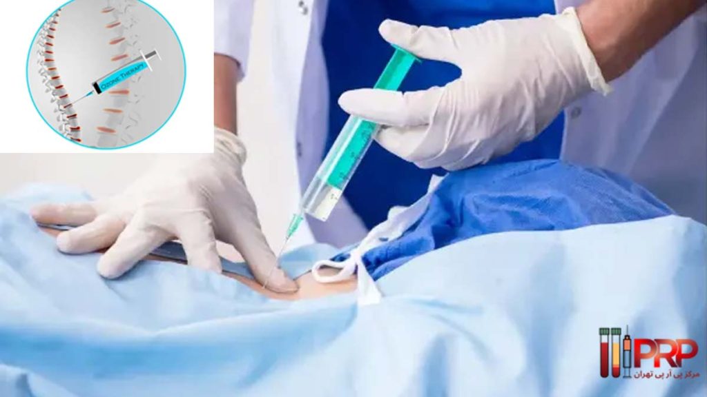 هزینه اوزون تراپی دیسک کمر
