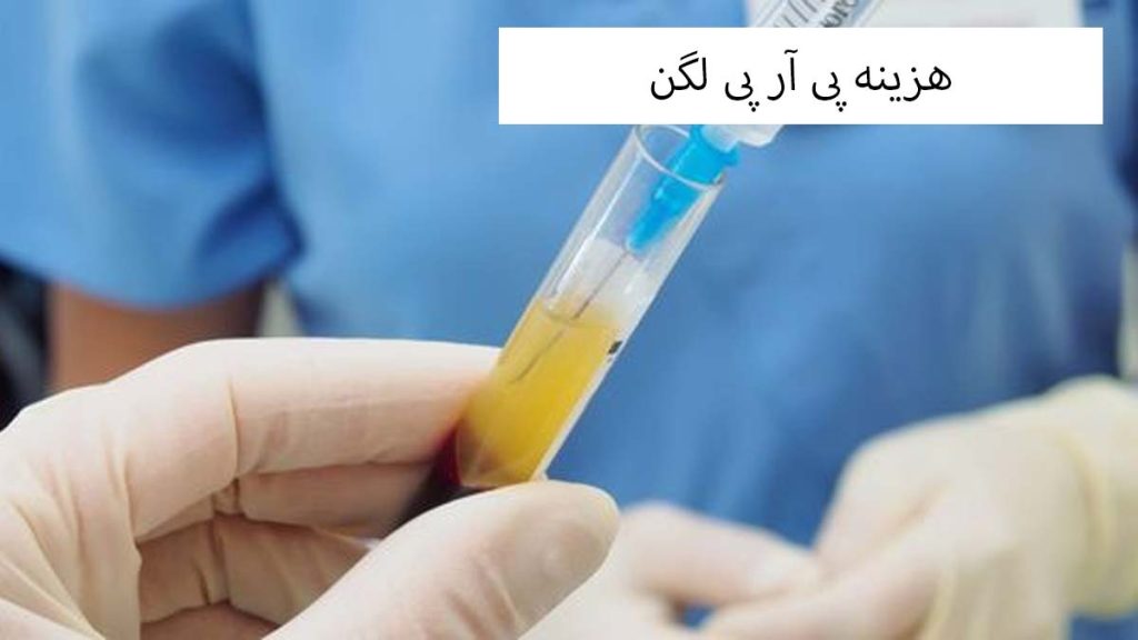 هزینه پی آر پی لگن