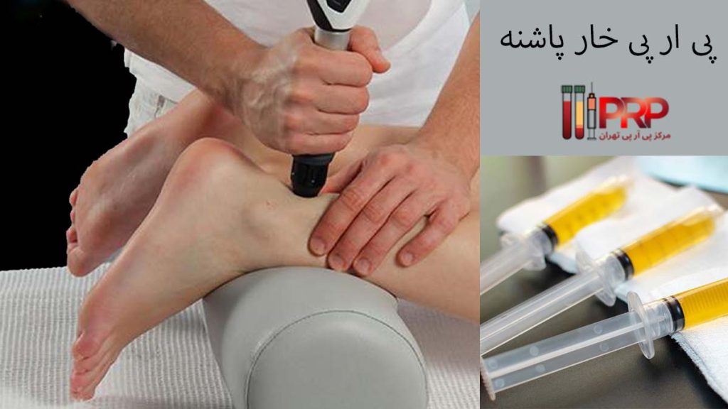 پی ار پی خار پاشنه