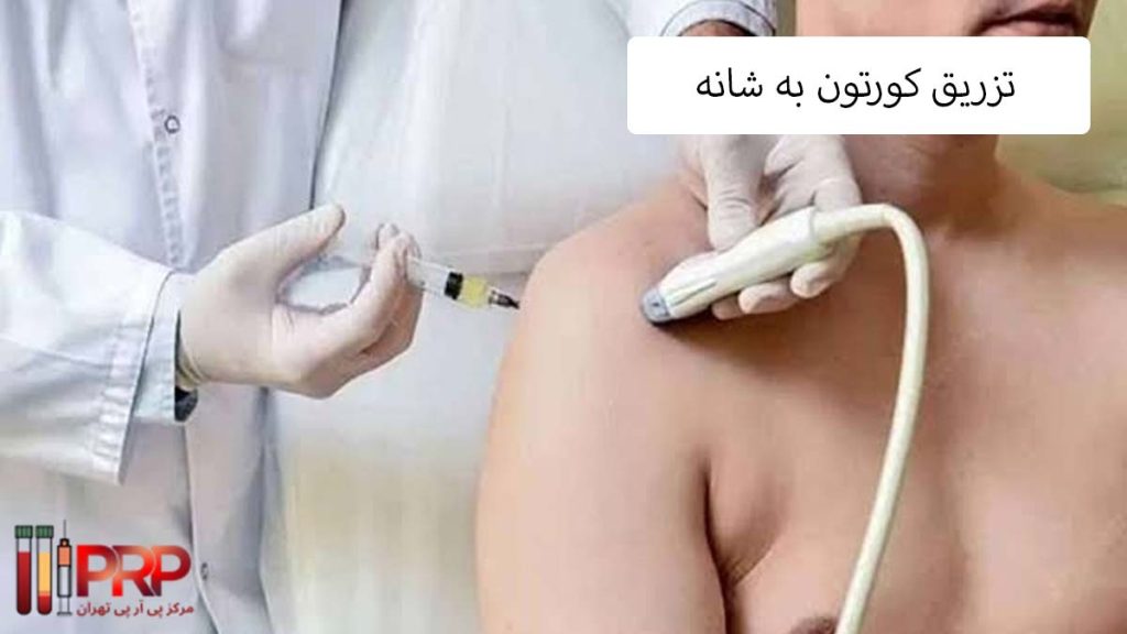 قیمت کورتون جهت تزریق به شانه هزینه تزریق کورتون به شانه